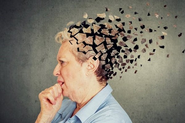 Alzheimerın Bazı Erken Uyarı İşaretleri Otuzlu Yaşlarınızda Ortaya Çıkabilir
